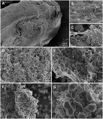 “Time lost is clot resolution lost”: the neglected perspective of the therapeutic time window for ischemic stroke